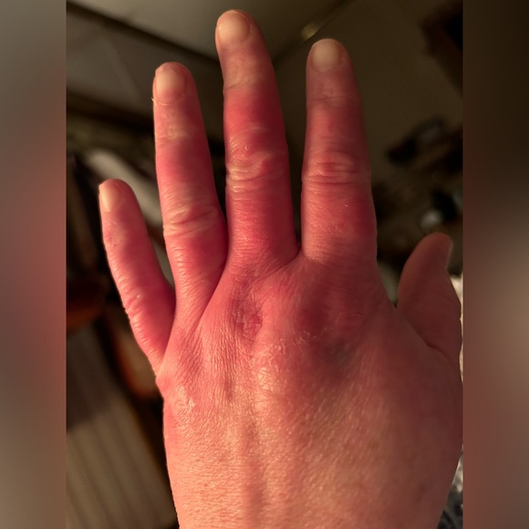 Your purchases help me while i try to get disability for a rare brain disease - Picture 4 of 10